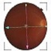 Vitreo-Retina